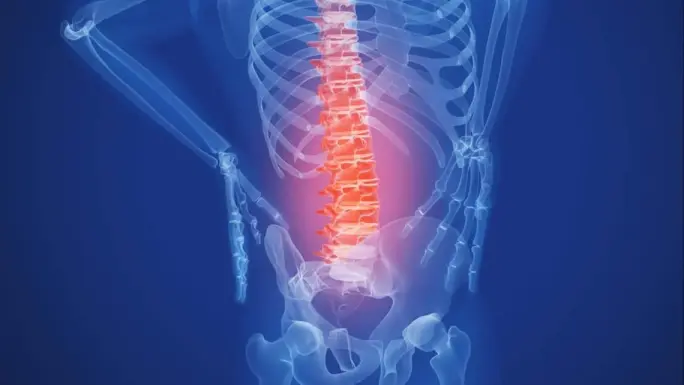 Pilates para el dolor de espalda en Santander