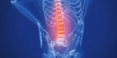 Pilates para el dolor de espalda en Santander